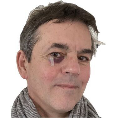 avatar for Hervé Becquart